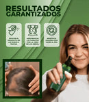 OUHOE® 2X1 HAZ CRESCER TU CABELLO EN 14 DIAS - ¡Compra 1 y llévate 2! + 5 Regalos
