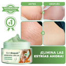CREMA ANTIESTRÍAS SKINREPAIR
